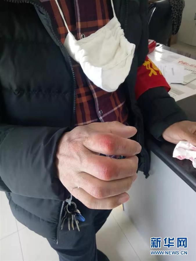 （在習近平新時代中國特色社會主義思想指引下&mdash;&mdash;新時代新作為新篇章&middot;習近平總書記關切事&middot;圖文互動）（2）戰(zhàn)&ldquo;疫&rdquo;中的&ldquo;凡人微光&rdquo;